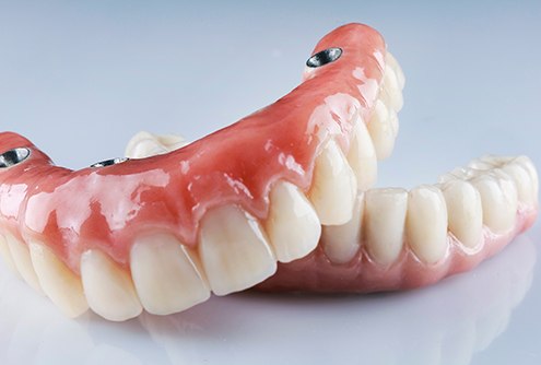 a close-up of implant dentures