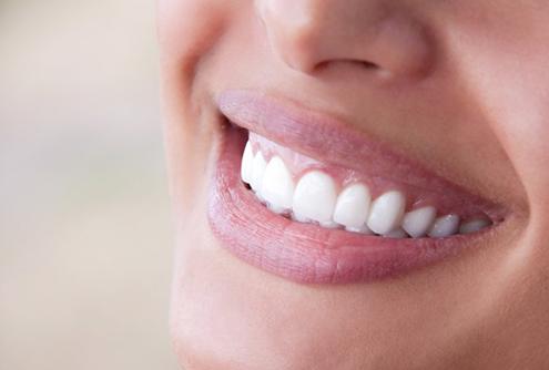 Closeup of beautiful smile with dental bonding in McMinnville