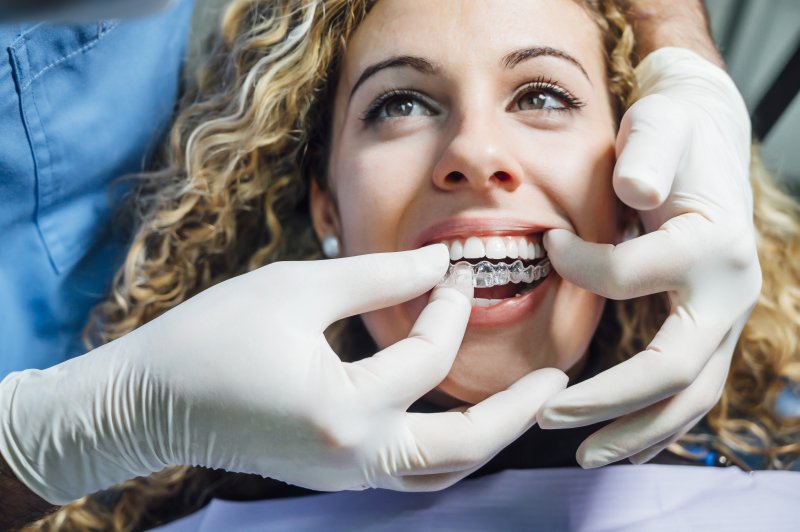 The Modern Approach to Overbite Correction with Invisalign